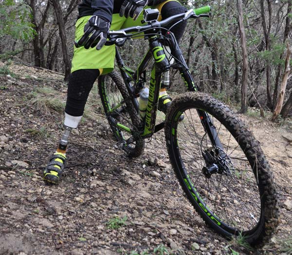 Custom Crafted Prosthetics